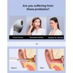 BEBIRD T5 3MP KAMERA 3.5MM LENS ŞARJLI WIFI GÖRÜNTÜLÜ KULAK TEMİZLEYİCİ BEYAZ RENK - Görsel 2