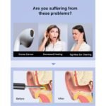 BEBIRD T5 3MP KAMERA 3.5MM LENS ŞARJLI WIFI GÖRÜNTÜLÜ KULAK TEMİZLEYİCİ SİYAH RENK - Görsel 2